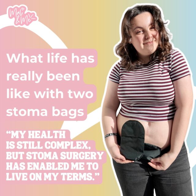 It's time for a check-in - the realities of life since surgery.Image description listed on each image.